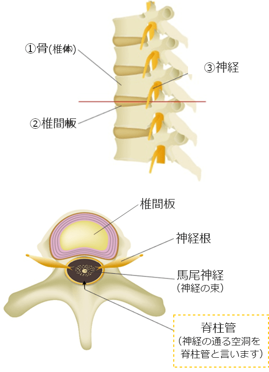 脊柱管狭窄症のイメージ