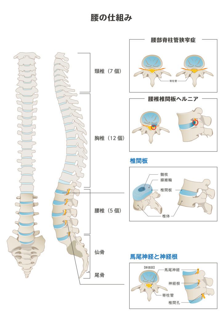 脊柱管狭窄症と脊椎の図