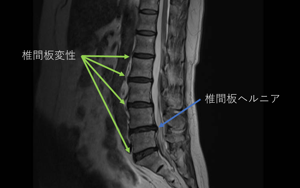 腰痛・下肢痛の診断と治療 ～骨盤と腰椎、股関節の関係を診る～全2枚